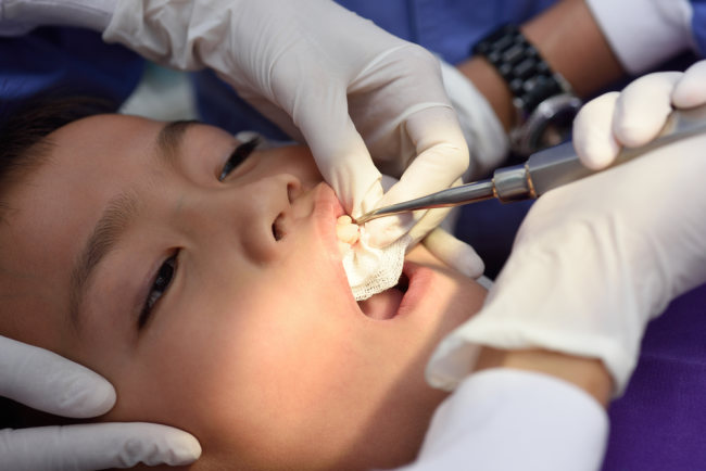 Obat Sakit Gigi untuk Anak yang Sebaiknya Orang Tua Berikan